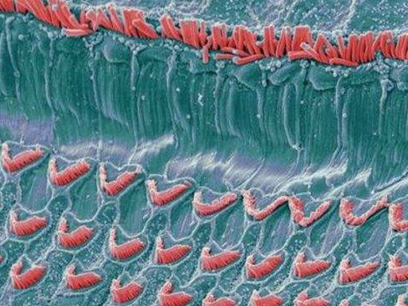 毛细胞可能治愈皮肤疤痕_Hair Cells Could Heal Skin Sans Scars